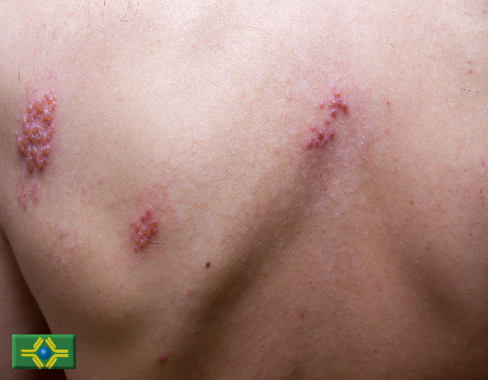 AdobeStock 103871203 1