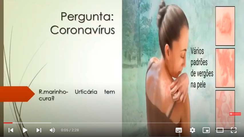 Urticária e Coronavírus